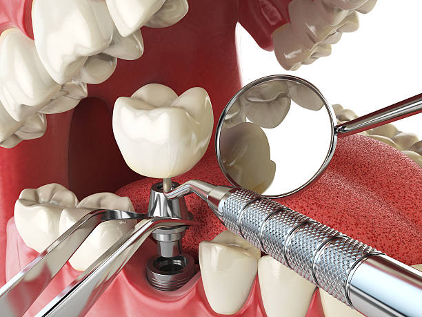 Best Emergency Dental Care for Trauma or Injury in Altamont, IL